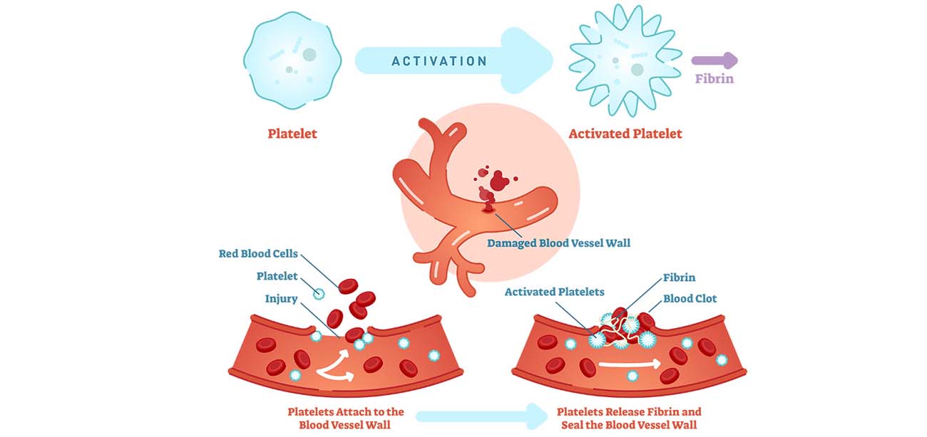 Platelets Disorder