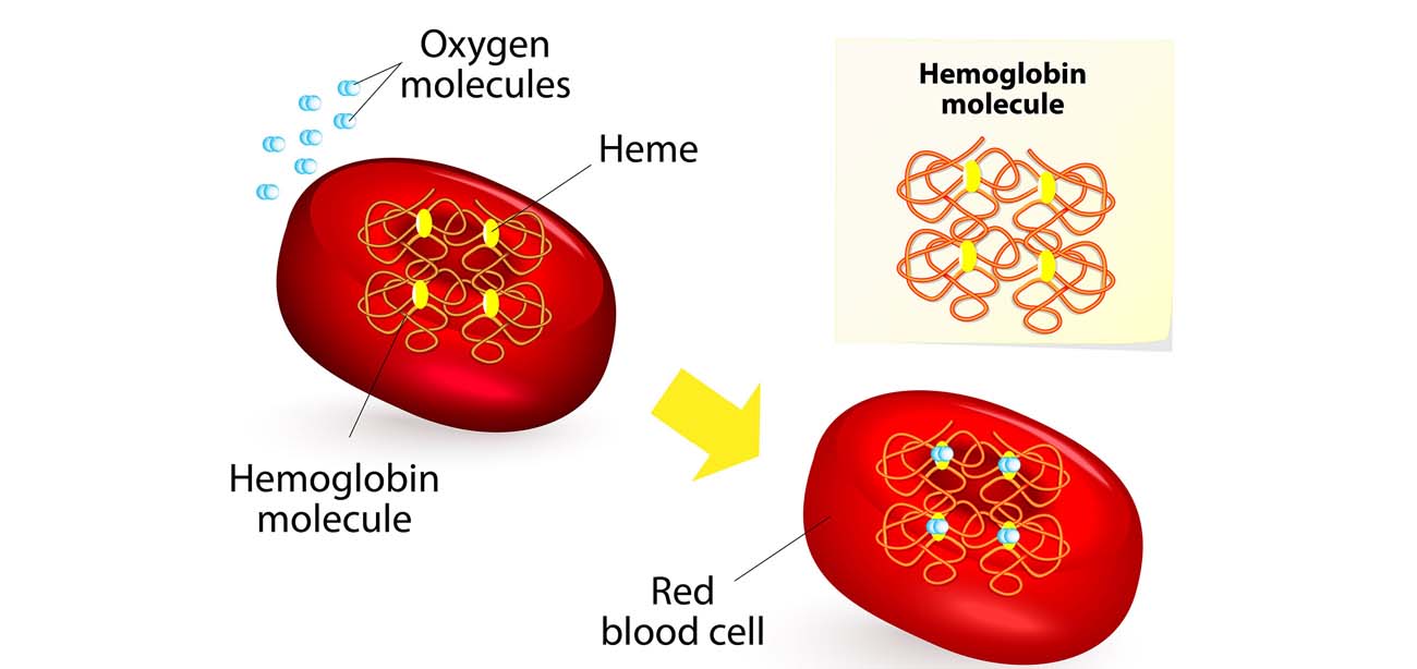 Thalassemia